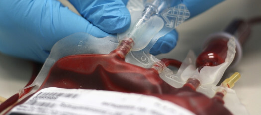 cofen-abre-consulta-publica-sobre-uso-terapeutico-de-concentrados-sanguineos-autologos-nao-transfusionais